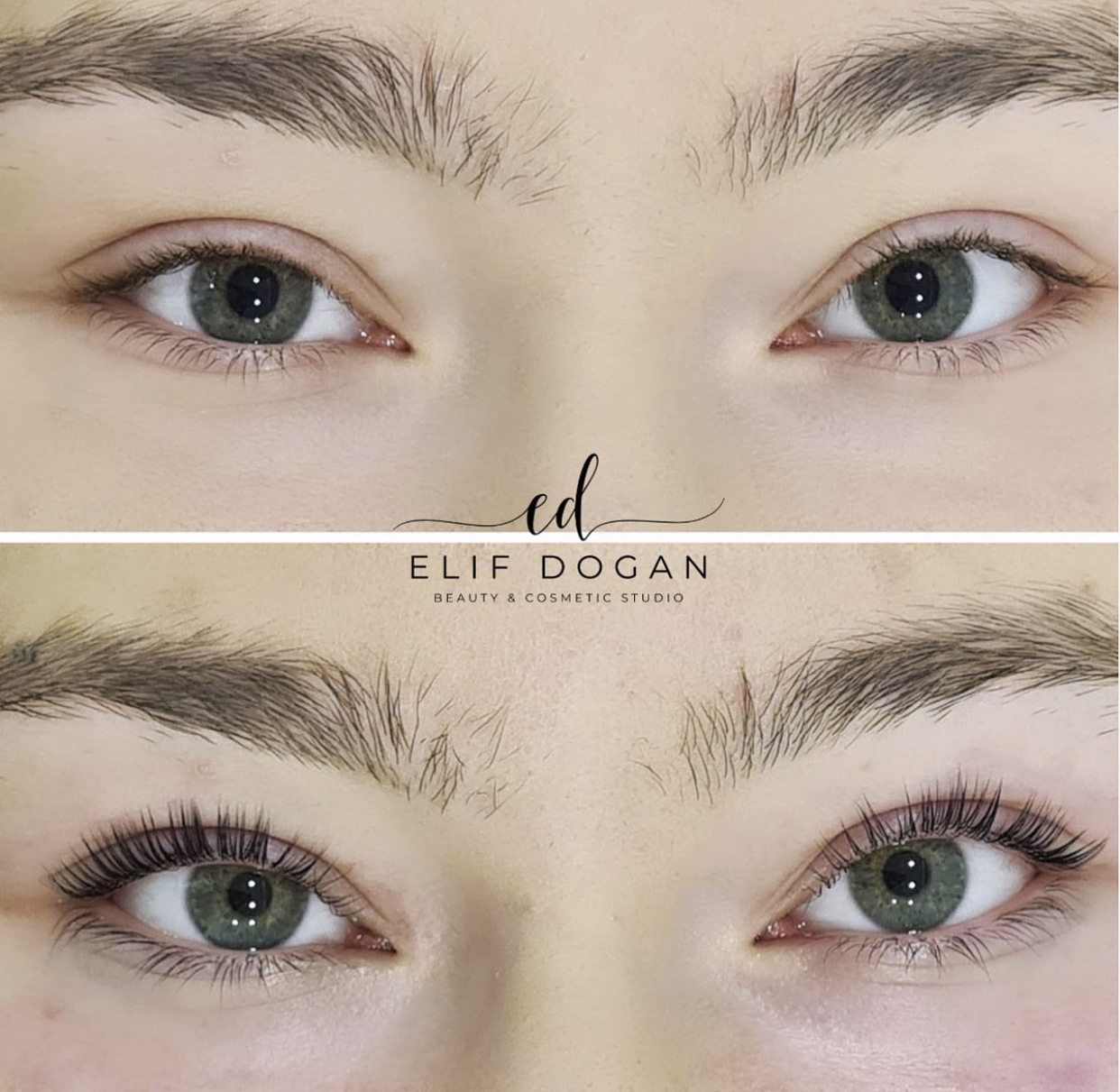 BEAUTY LOUNGE by Elif Dogan – Zahnaufhellung